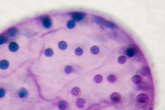 pond life volox micrograph