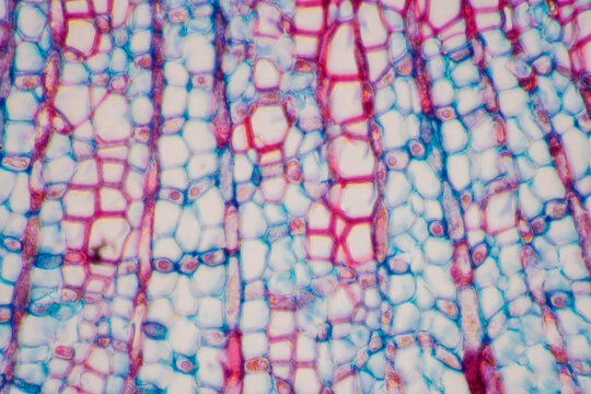 micrograph plant cells of woody dicot stem