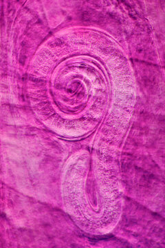 parasite Trichinella spiralis w.m