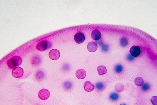 pond life volox micrograph