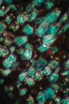 herbal medicine Amomum villosum Lour seed