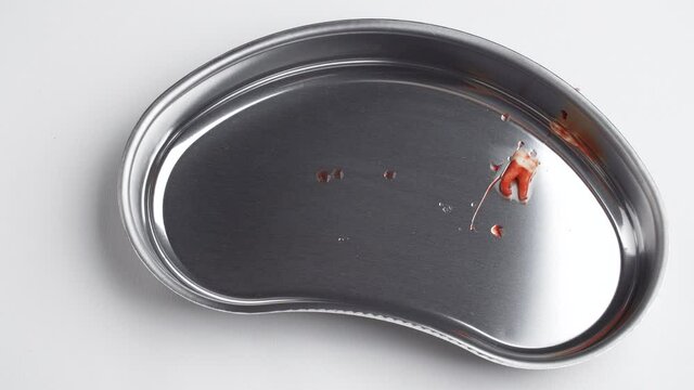 Bloodied wisdom tooth in a kidney-shaped tray
