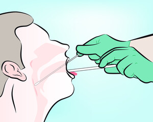 step 4 : For throat swab, take a second dry polyester swab, insert into mouth, and swab the posterior pharynx and tonsillar areas. (Avoid the tongue).