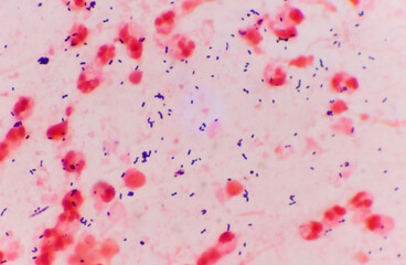 Bacteria Gram positive in sputum gram stain.
