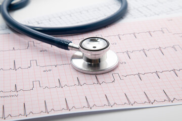 Blue Stethoscope on electrocardiogram (ECG) chart paper. ECG heart chart scan isolate on white....