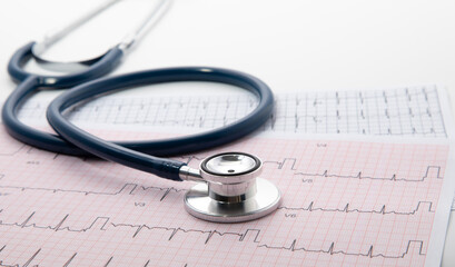 Blue Stethoscope on electrocardiogram (ECG) chart paper. ECG heart chart scan isolate on white....
