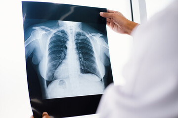 Radiology doctor examining at chest x ray film of patient at health care clinic