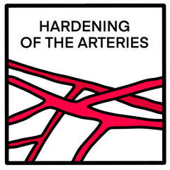 Hardening of arteries hand drawn vector illustration icon in cartoon comic style red vessels