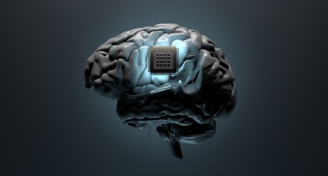 Neurotechnology, implantable brain machine, chip inserted into brain.
