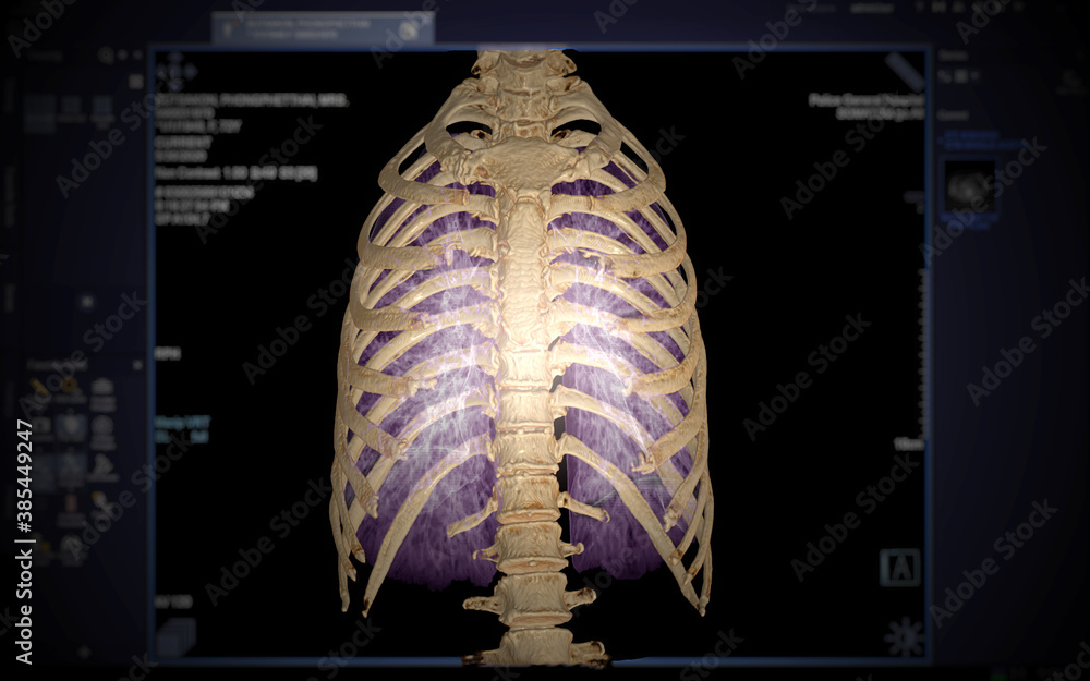 Poster ct chest with 3d rendering of lung and rib on monitor background.3d illustration.