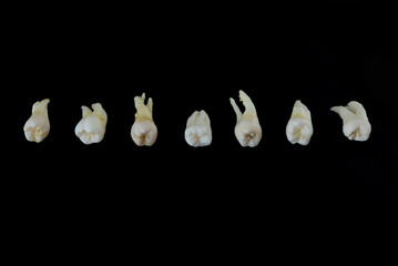Torn diseased human teeth stacked in a row isolated on black background. Close-up photo of spoiled...