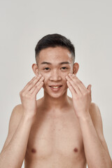 Portrait of young asian man with problematic skin and hyperpigmentation smiling at camera, applying...