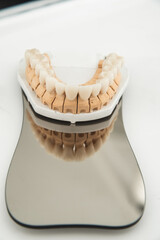 An artificial jaw with veneers and crowns, stands on a surgical glass in a stolmatologic office. Dentistry and treatment concept