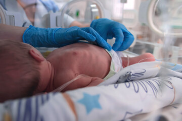 Nurse in blue gloves takes action to monitor and care for premature baby, selective focus. Newborn is placed in the incubator. Neonatal intensive care unit