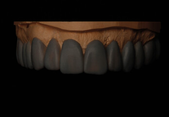 dentistry, macrophotography, macro, macrophoto, teeth, tooth, wax-up, dental design, smile design,