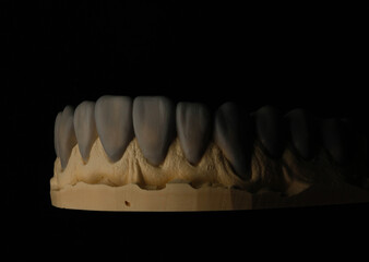 dental photography, dental photo, dentistry, macro photo, macrophotography, smile design, wax-up,...