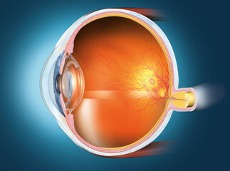 Human eye with artificial lens, medically 3D illustration