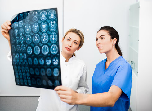 Experienced woman neurologist and radiologist are looking at an MRI scan of a patient's head. Diagnostics and treatment of brain diseases, headaches, tumors and brain cancer