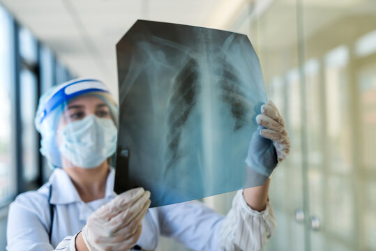 young nurse in a protective suit and face shield checking chest xray image, covid19