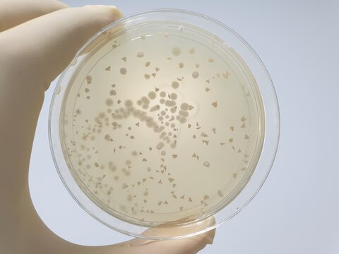 Saccharomyces boulardii microbial culture results