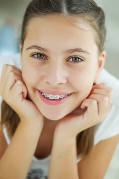 Close up portrait of smiling teenager girl showing dental braces.Isolated on white background. High quality photo.
