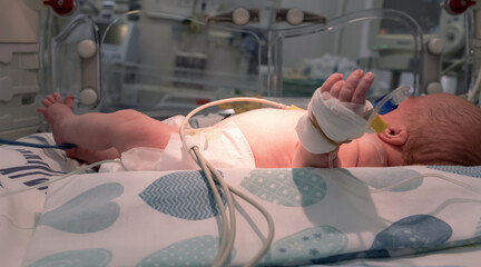 Photo of a newborn premature sick baby in incubator with monitoring sensors and catheters. Neonatal...