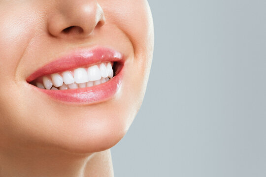 Perfect healthy teeth smile of a young woman. Teeth whitening. Dental clinic patient. Stomatology concept.