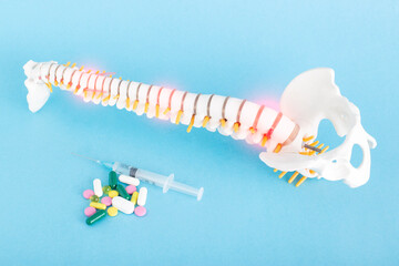 A model of the spine on a blue background near which there are pills and injections. Concept of...