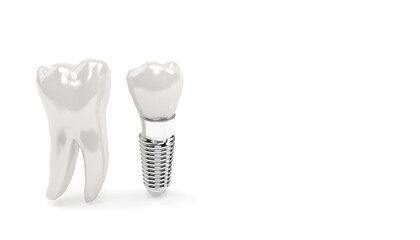 Tooth or Dental implant, human denture close-up 3d illustration. Teeth root embed in jaw bone to support artificial crown. Anatomy concept isolated on  background with copy space.  