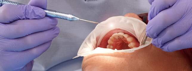 Dentist doctor working with patient