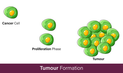 cancer cell formation due to mutagenic even vector concept inphograph. mutagenesis or tumorigenesis,  mechanism, steps of cancer formation. science and education purpose.