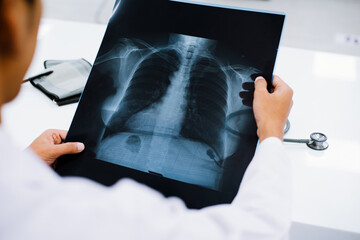 Radiology doctor examining at chest x ray film of patient at health care clinic
