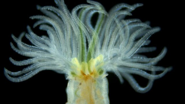 Worm Manayunkia baicalensis under a microscope, of the family Fabriciidae, has a corolla of tentacles at the front end with which they breathe. They feed on detritus. Sample found at Lake Baikal