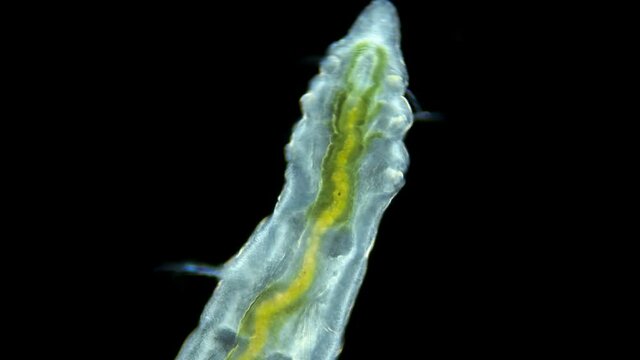 Worm Manayunkia baicalensis under a microscope, of the family Fabriciidae. The video shows the back of the worm. They feed on detritus. Sample found at Lake Baikal