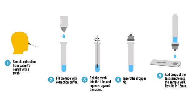 How Rapid COVID-19 Antigen Tests Work