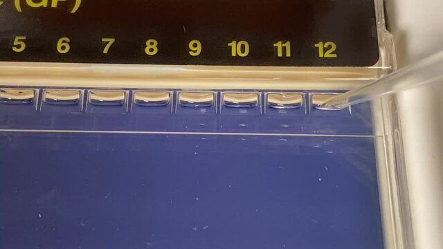 Biomolecular technician loading DNA sample on Agarose gel electrophresis. Close-up