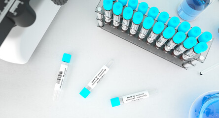 Coronavirus blood testing in a laboratory for Covid-19 top view. Covid medical screening. Blood samples in glass test tubes flat lay. 