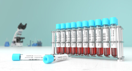 Coronavirus blood testing in a laboratory for Covid-19 . Covid medical screening. Blood samples in...