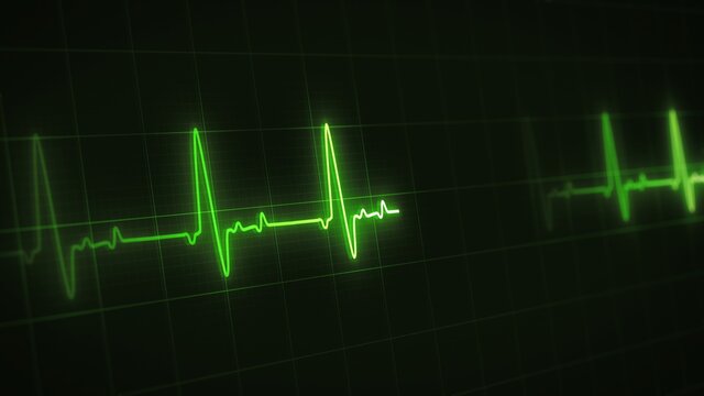 Green colored heart rate or heart beat line. Cardiogram signal monitoring. Isolated on black. Patient's vital signs. EKG, ECG curve. Pulse measuring. Medical Cardiological illustration. Life support