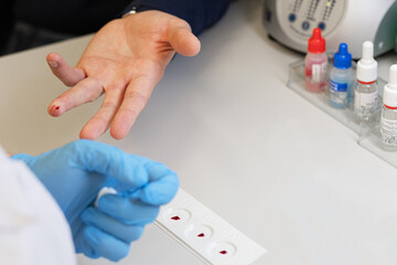 doctor taking an analysis, test from the finger of patient to determine the blood group and Rh factor in the laboratory