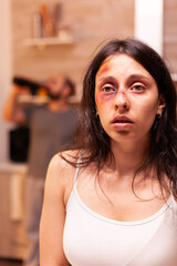 Woman in pain suferring after being brutality beaten by drunk violent husband in anger rampage....