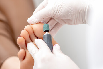 Peeling feet pedicure procedure from callus on foot by hands of podiatrist in white gloves at...