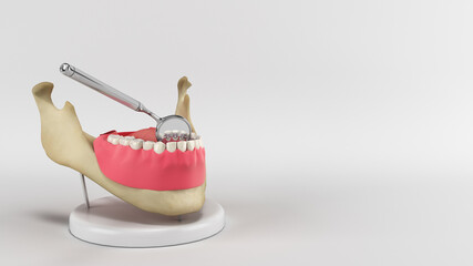 Lingual braces system on a demonstration denture 3d render image