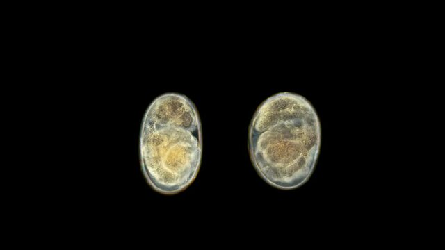 Crustacea Amphipoda eggs with embryos under a microscope, Gammarida Infraorder, sample found at Lake Baikal