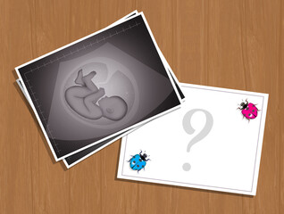 will the male or the female be born?
