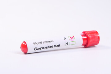 close up of corona virus blood test tube on white background 