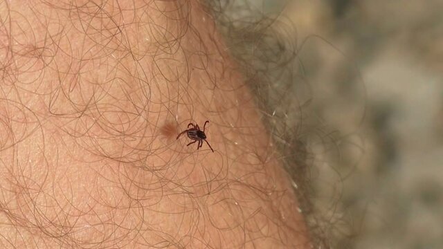 Insect parasite mite crawls on a man's leg. Tick on the skin.