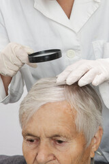 Doctor examining senior woman's hair scalp, scalp eczema, dermatitis, psoriasis, hair loss, dandruff or dry scalp problem