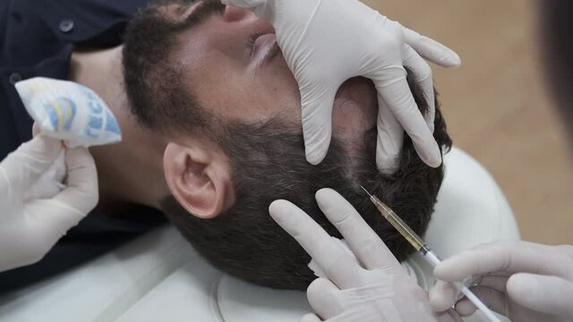 Hair mesotherapy or scalp prp: Platelet-rich plasma procedure. Beautician doctor makes injections in the man head for hair growth to prevent hair loss and baldness