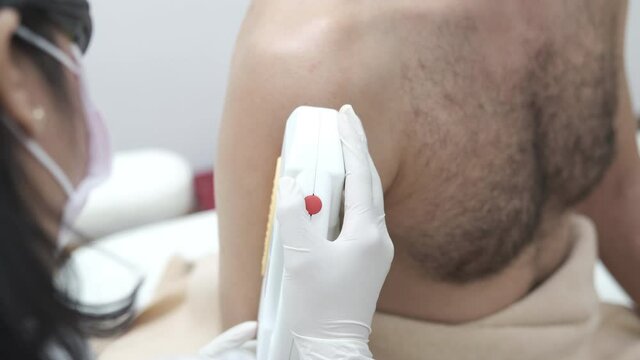Young man getting arm and shoulder laser hair removal epilation. IPL treatment in cosmetic beauty salon